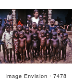 #7478 Picture of a Nurse Standing with a Group of African Children Showing Symptoms of the Protein-Deficiency Disease Kwashiorkor by KAPD