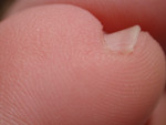 Free Picture of Pinky Toe and Nail