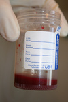Free Picture of Container of Blood