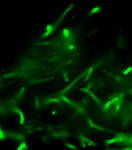 Free Picture of Anthrax Direct Fluorescent Antibody (DFA) Cell Wall Stain