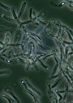 Free Picture of Bacillus Anthracis Spores Seen Under Phase Contrast Microscopy