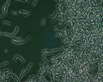 Free Picture of Anthrax Spores