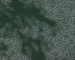 Free Picture of Bacillus Anthracis Spores