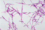 Free Picture of Bacillus Anthracis Gram Stain