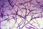 Free Picture of Anthrax Bacteria Displayed During a Gram Stain Technique
