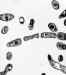 Free Picture of Bacillus anthracis (Anthrax)