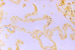 Free Picture of Bacillus Anthracis in a Lung