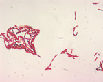 Free Picture of Bacillus Species Malachite Green Spore Stain