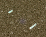 Free Picture of Bacillus Anthracis Indian Ink Capsule Stain