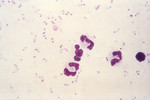 Free Picture of Micrograph of Plasmodium Falciparum Parasites in the Form of Numerous Rings