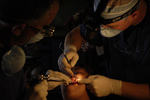 Free Picture of Performing a Tooth Extraction