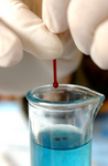 Free Picture of Testing Blood for Iron Levels